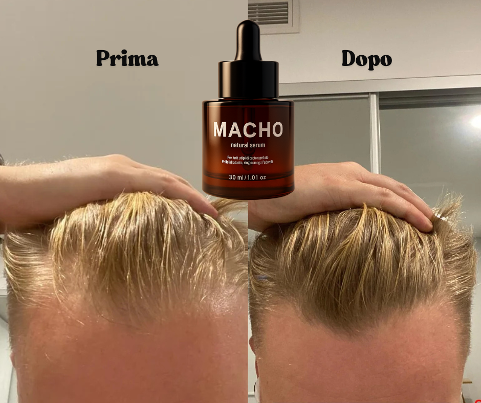Macho Serum - Siero Naturale per la crescita dei capelli