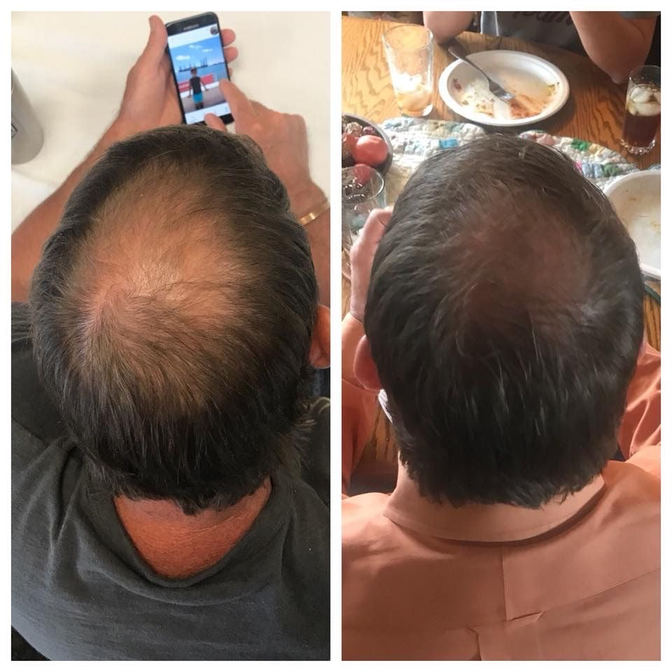 Macho Serum - Siero Naturale per la crescita dei capelli