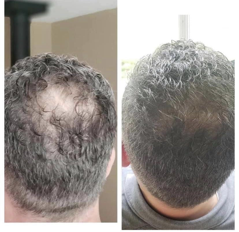Macho Serum - Siero Naturale per la crescita dei capelli