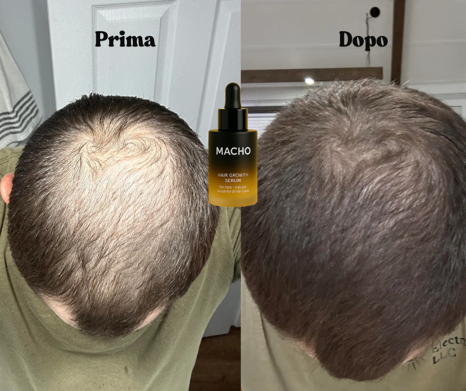 Macho Serum - Siero Naturale per la crescita dei capelli