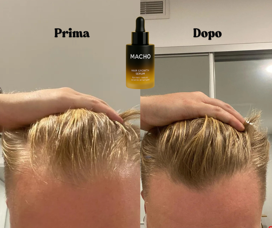 Macho Serum - Siero Naturale per la crescita dei capelli